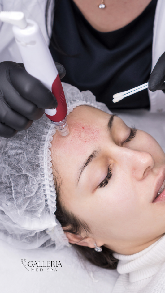 Micro needles 45 min